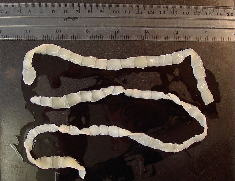 extensive tapeworm in the human body