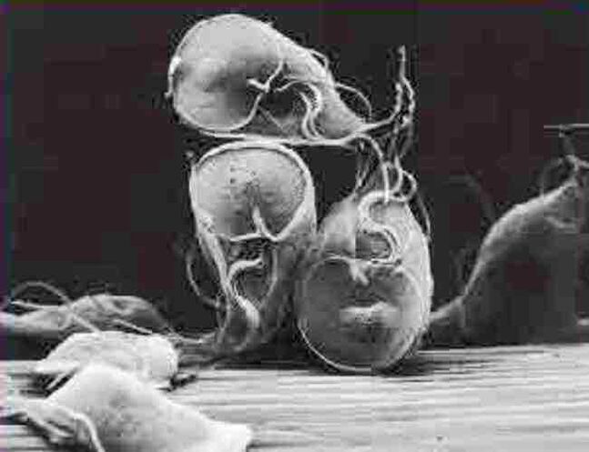 protozoan parasitic giardia